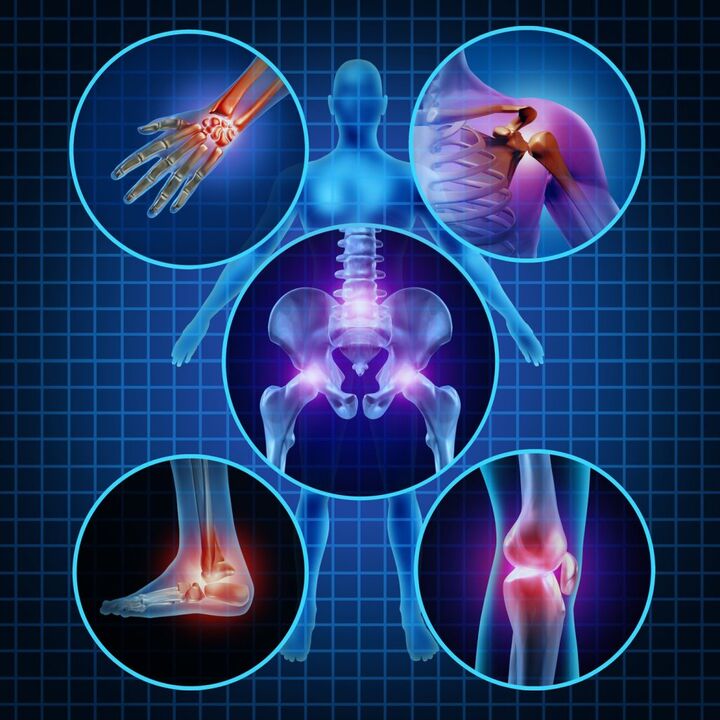 joints affected by osteoarthritis