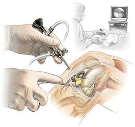 Clarification of the diagnosis of osteoarthritis of Dash medicine